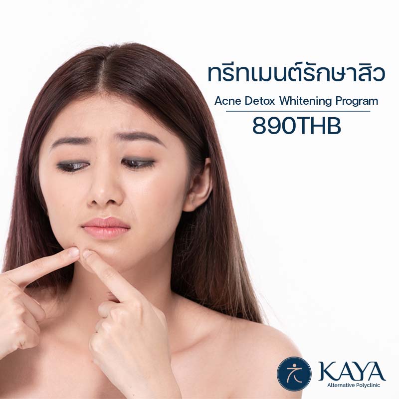 ทรีทเมนต์รักษาสิว