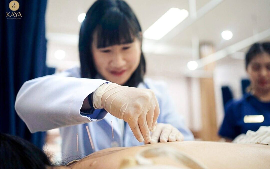 รีวิวฝังเข็มลดอาการปวดจากการทำคีโม