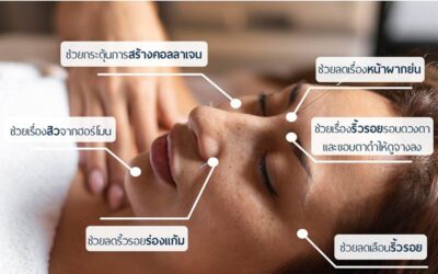 จุดฝังเข็มบนใบหน้า