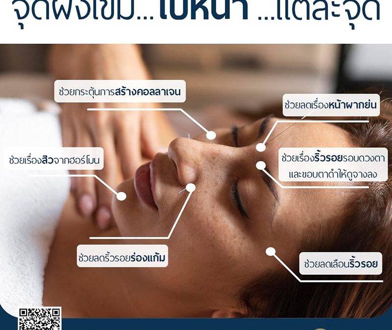 จุดฝังเข็มบนใบหน้า