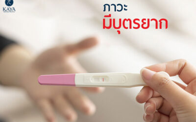 ฝังเข็มรักษาภาวะมีบุตรยาก