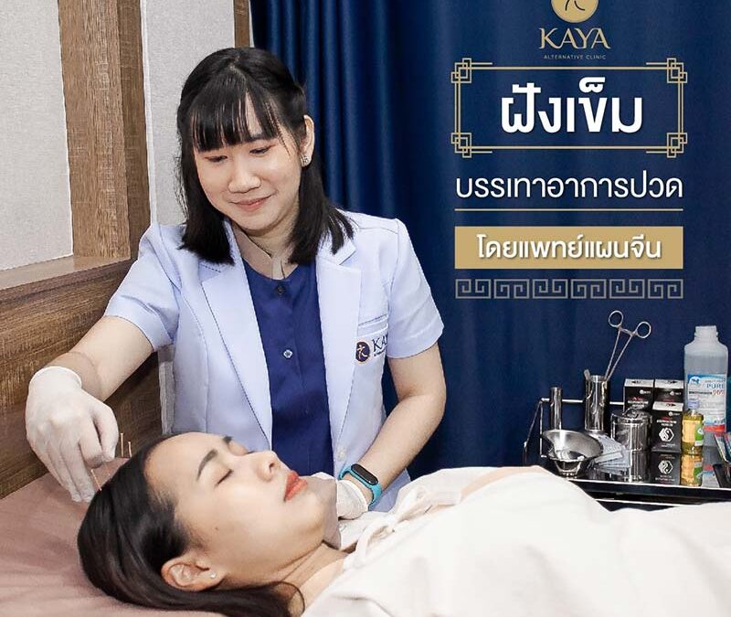 โปรโมชั่นฝังเข็มรักษาอาการปวด