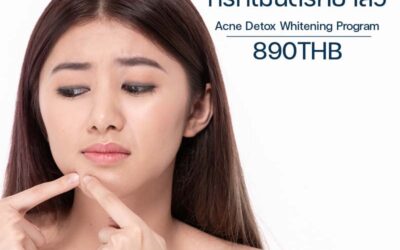 ทรีทเมนต์รักษาสิว