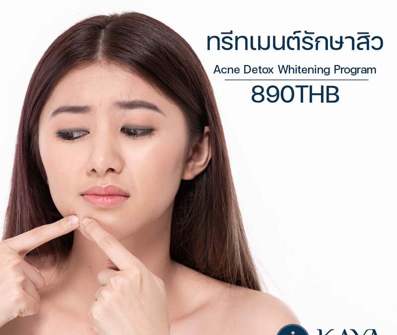 ทรีทเมนต์รักษาสิว